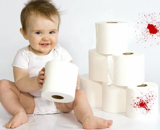 Що робити якщо у дитини пронос з кров’ю? — перша допомога