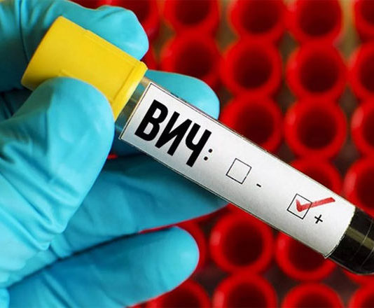 Як проявляється діарея при ВІЛ інфекції і як його лікувати?