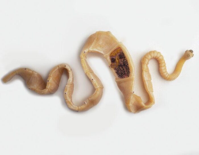 Наслідки присутності глистів і паразитів в організмі людини