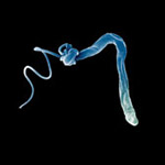 Наслідки присутності глистів і паразитів в організмі людини